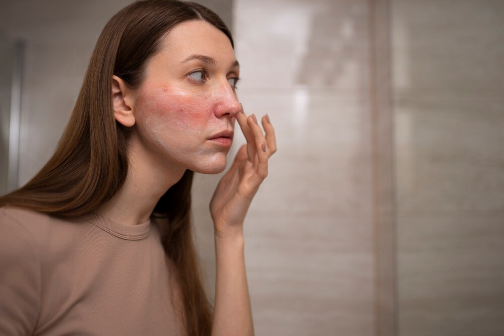Woman looking at her rosacea in the mirror